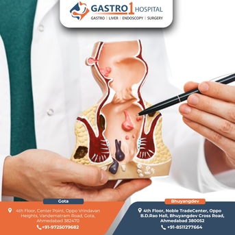 Ahmedabad, Health, Gastro1 Hospital - Piles Treatment In Ahmedabad With Advanced Laser Surgery
