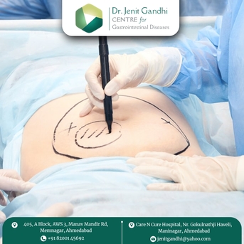 Ahmedabad, Health, Dr. Jenit Gandhi &ndash; Colorectal Surgeon In Ahmedabad For Safe & Effective Surgery