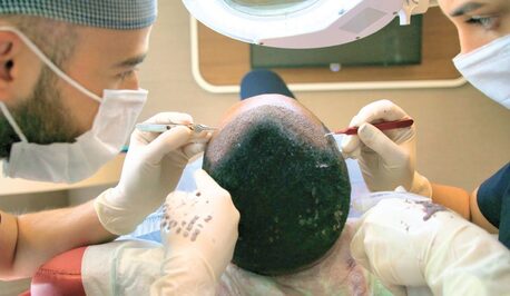 Mumbai, Health, Best Hair Transplant Clinic In Mumbai For Natural Results