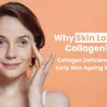 Collagen Loss