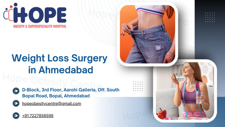 Ahmedabad, Health, Medical Weight Loss Surgery Clinic In Ahmedabad