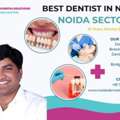 Affordable Teeth Aligners Treatment In Noida With Advanced Dental Care
