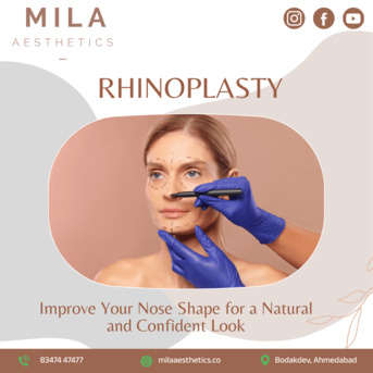 Ahmedabad, Health, Mila Aesthetics &ndash; Transform Your Look With Rhinoplasty In Ahmedabad