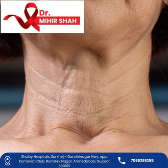 Ahmedabad, Health, Senior Specialist Head And Neck Cancer Surgeon In Ahmedabad Dr Mihir Shah