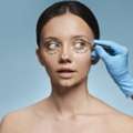Baggy Eyelid Surgery In Lucknow
