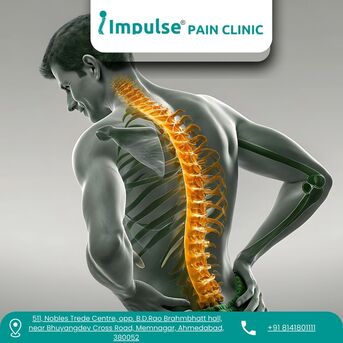 Ahmedabad, Health, Sciatica Pain Treatment In Ahmedabad &ndash; Impulse Pain Clinic