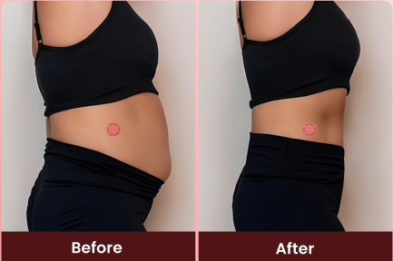 London, Health, Surgonix Reviews Honest Analysis &ndash; Is It Safe And Effective?