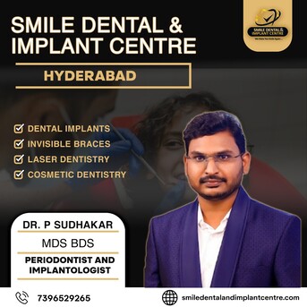 Hyderabad, Dental, Best Dentist Near Me In Secunderabad For All Dental Treatments