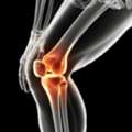 MRI Of Knee Joint &ndash; Accurate Joint Imaging & Fast Appointments | Book Now +44 203 011 1788