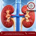 Expert Kidney Cancer Surgeon In Ahmedabad &ndash; Dr. Nitin Singhal