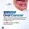 Oral Cancer Awareness | Best Oncologist In Bhubaneswar | Dr. Srigopal Mohanty