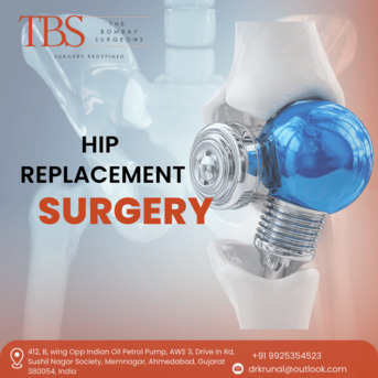 Ahmedabad, Health, Dr. Krunal Soni &ndash; Expert Hip Replacement Surgery In Ahmedabad