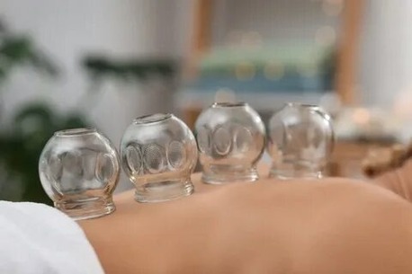 Bangalore, Health, Trusted Cupping Therapy Treatment In Bangalore For Natural Healing