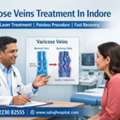 Varicose Veins Treatment In Indore - Sahaj Hospital