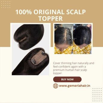 Noida, Clothing & Accessories, Buy The Best Scalp Topper For Thinning Hair &ndash; Natural Scalp Coverage