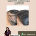 Hair GFC Treatment In Vizag - Derma One Clinic