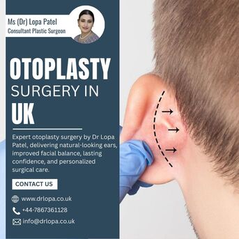 London, Health, Expert Otoplasty Surgery In The UK By Dr Lopa Patel