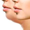 The Best Non-Surgical Methods For Double Chin Removal