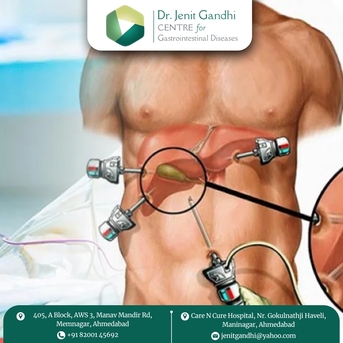 Ahmedabad, Health, Best Gallbladder Surgeon In Ahmedabad, India For Laparoscopic Care