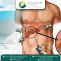 Best Gallbladder Surgeon In Ahmedabad, India For Laparoscopic Care