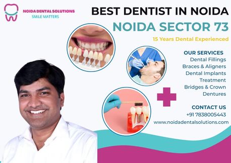 Noida, Dental, Expert Root Canal Specialist In Noida Offering Painless Dental Solutions