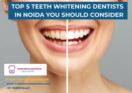 Noida, Dental, Expert Root Canal Specialist In Noida Offering Painless Dental Solutions