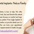 USD 199,  We Offer Dental Implants: Nukoa Family Dentistry
