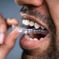 Choosing Braces Orthodontics For Long-Term Smile Results
