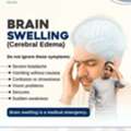 Brain Swelling (Cerebral Edema) | Best Neurosurgeon In Bhubaneswar | Dr Srikant Swain