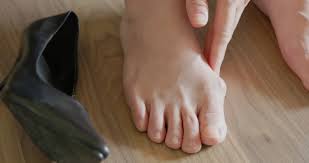 Singapore, Health, 4 Essential Timeline For Bunion Surgery Recovery