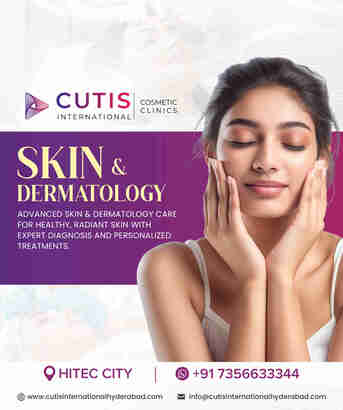 Hyderabad, Health, Professional Skin Care By Leading Dermatologists In Hyderabad