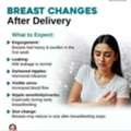 Breast Changes After Delivery | Dr. Monalisha Naik, Bhubaneswar
