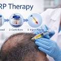 PRP Therapy Etobicoke