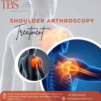 Ahmedabad, Health, Dr. Krunal Soni &ndash; Trusted Shoulder Arthroscopy Treatment In Ahmedabad