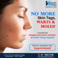 No More Skin Tags, Warts, & Moles | Best Hospital In Bhubaneswar | Health Village Hospital