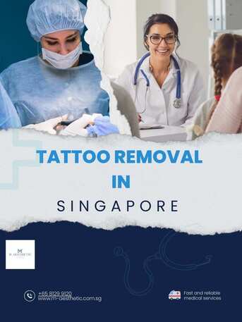 Singapore, Health, Tattoo Removal Singapore - Laser, Fast & Pain-Free Results