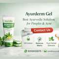 Best Ayurvedic Cream For Pimples And Acne