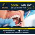 Dental Implant Cost In Hyderabad 2026 | Smile Dental And Implant Centre