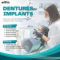 Why Patients Choose Dentures Implants For Full Mouth Restoration?
