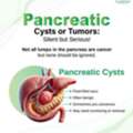 Pancreatic Cysts Or Tumours | Laparoscopic Surgeon In Bhubaneswar | Dr Satyajit Rath