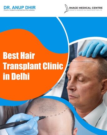 New Delhi, Health, Best Hair Transplant Clinic In Delhi