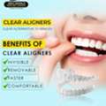Best Dental Hospital In Secunderabad For Invisalign Treatment