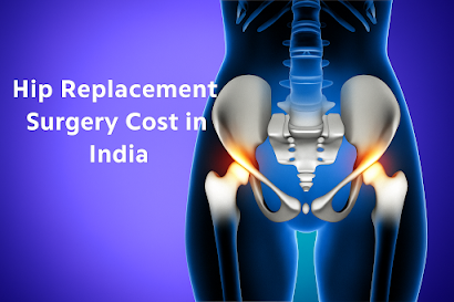 Nairobi, Health, Cost Of Hip Replacement Surgery In India &ndash; Quality Treatment At Affordable Prices