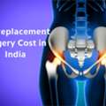 Cost Of Hip Replacement Surgery In India &ndash; Quality Treatment At Affordable Prices