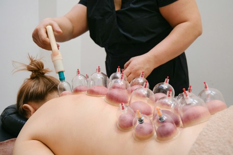 Bangalore, Health, Best Cupping Therapy In Bangalore With Professional Care