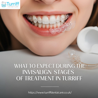 London, Dental, What To Expect During The Invisalign Stages Of Treatment In Turriff