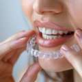 Achieve A Confident Smile | Invisalign Treatment In Mumbai  Description: