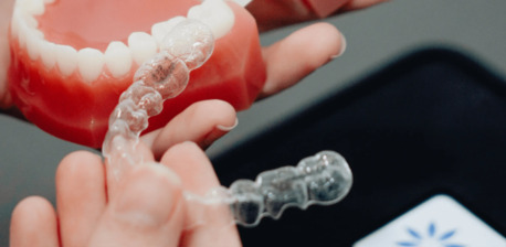 London, Dental, Best Invisalign Clear Aligners For Teeth Straightening Chesham UK