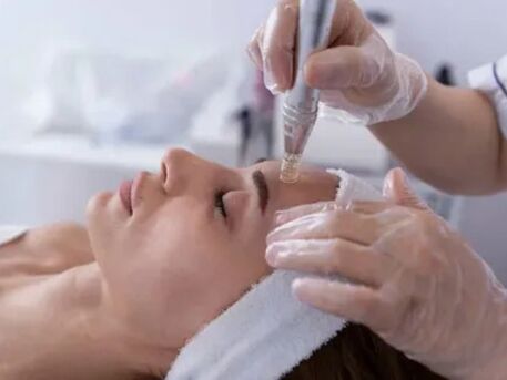Houston, Health, Microneedling Treatment Houston | Skin Rejuvenation Experts