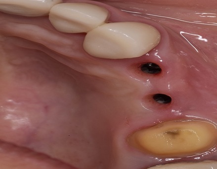 Mexico City, Dental, Holistic Dentist In Mexico &ndash; Natural, Biocompatible Care For Your Health And Smile